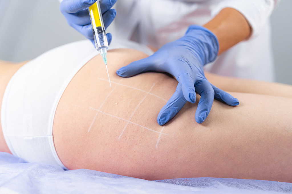 cropped-photo-professional-female-cosmetologist-gloves-performing-mesotherapy-procedure-cellulite Woman at Omnia Integrative Health & MedSpa in West Lawn, PA