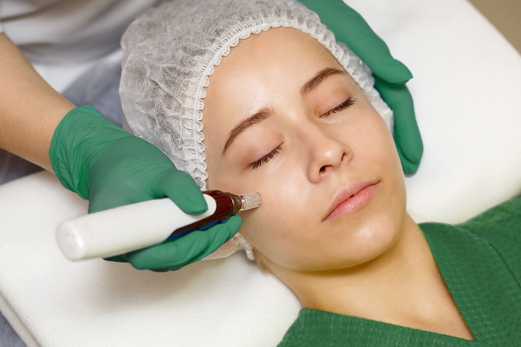 iStock-801021152_woman-microneedle Hardware cosmetology. Mesotherapy. Dermapen. Treatment of cheek zone. Spa treatments. Face rejuvenation.