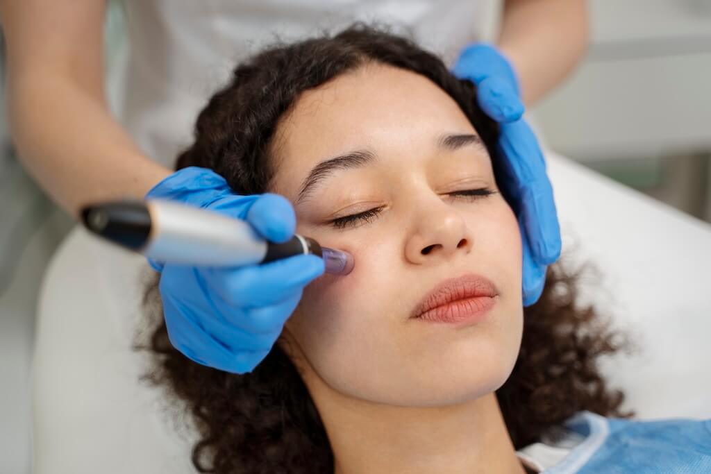 patient-undergoing-microneedling-procedure Woman undergoing microneedling with a Skin Sanctuary Injector